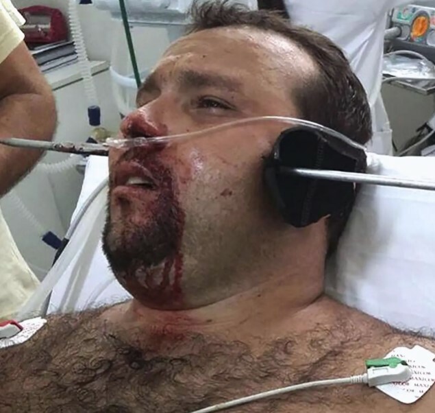 Spearfishing is dangerous