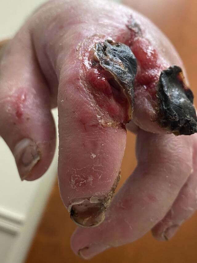 Knuckle Up