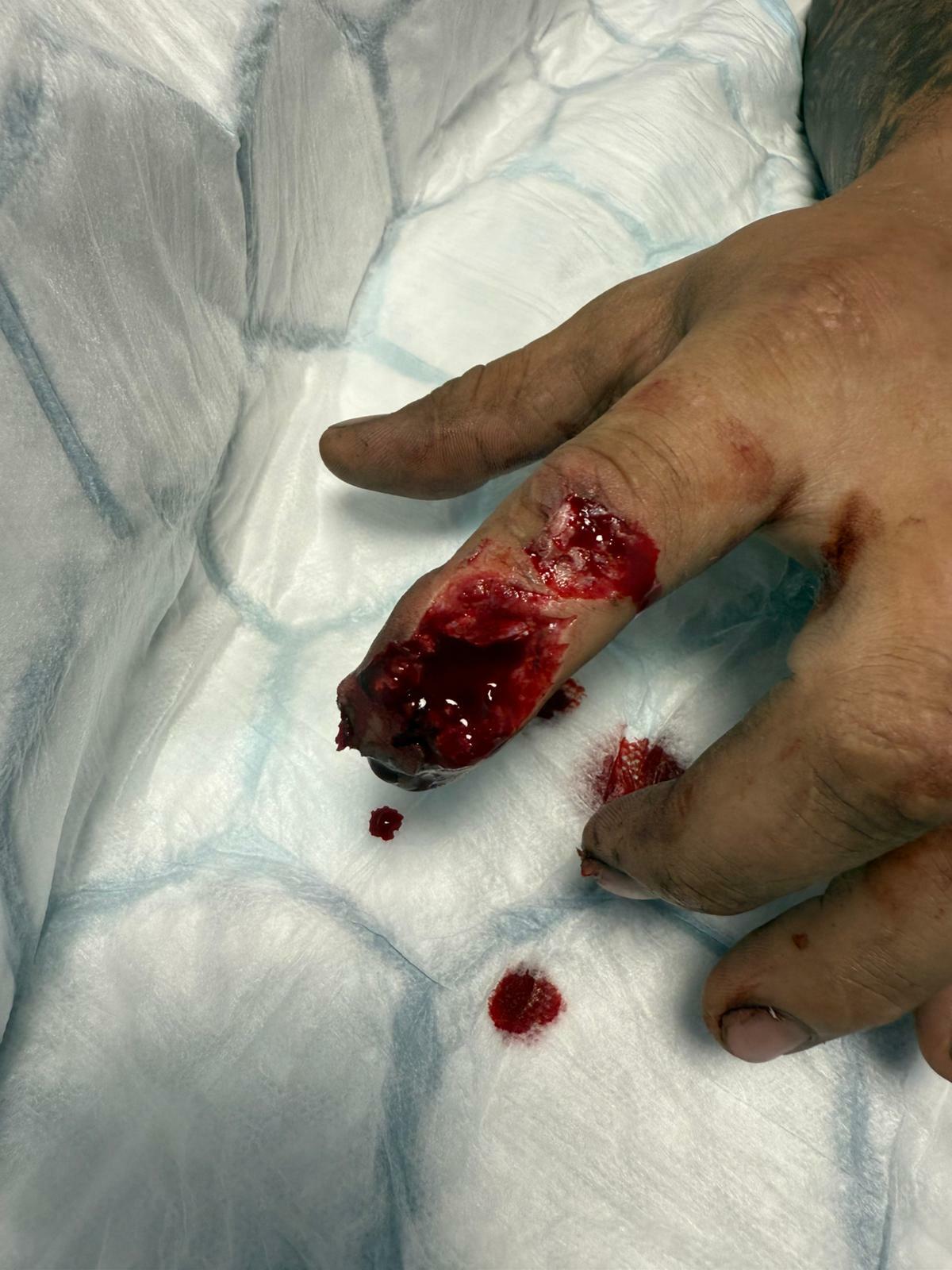 FINGER BANG