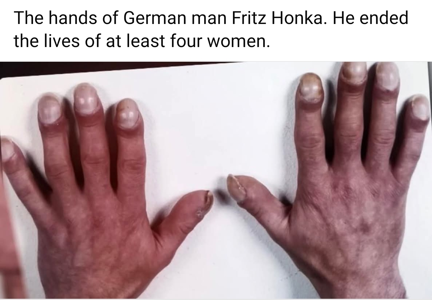 Fritz Kafka