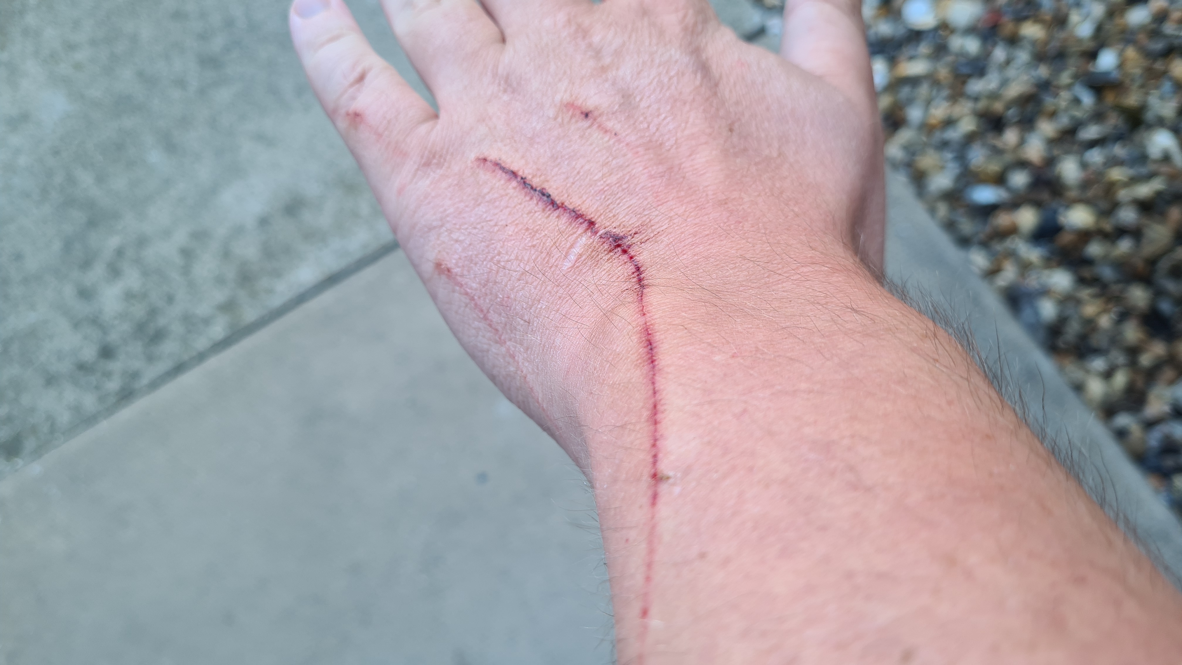 I Got Mangled By Pussy