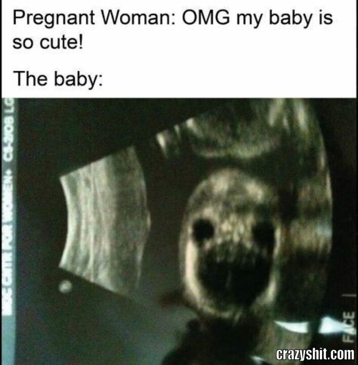 pregnant woman