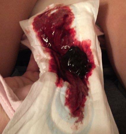 Nurse Ratched sent me thes pictures.