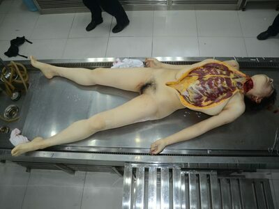 Chinese Woman Autopsy