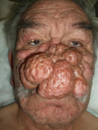 I Don&rsquo;t Nose&hellip;..