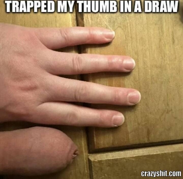 Hurts A Lot
