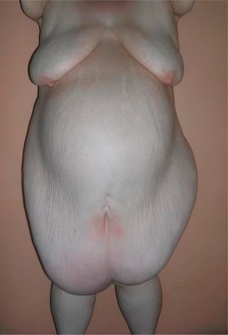 Apron&hellip;..