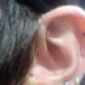 This is your ear on drugs