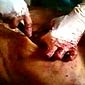 Burnt Guy Autopsy Video