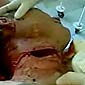 Doctors Stitch A Sliced Throat