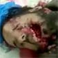Dead Libyan Protester
