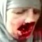Syrian Woman Shot In The Face