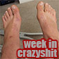Week In Crazyshit: Swollen Ankle