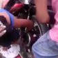 Woman's Hand Stuck In Moped Wheel