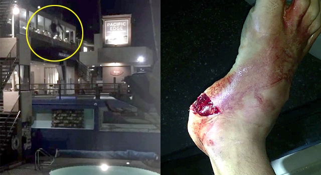 IDIOT BLOWS OUT BOTH ANKLES JUMPING FROM HOTEL ROOF