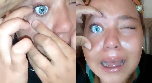 INSTANT REGRET: GIRL TRIES TO REPLACE EYE WITH A DOLL EYE