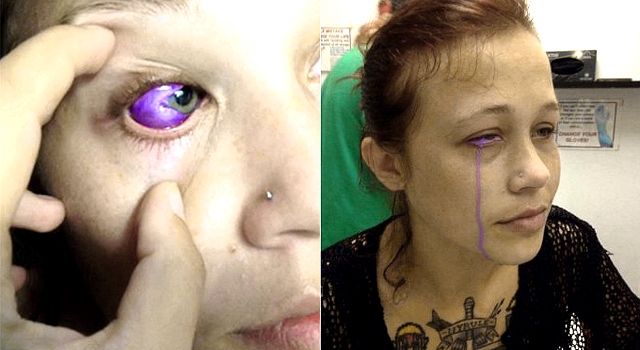 IT TURNS OUT, TATTOOING YOUR FUCKING EYEBALL IS A BAD IDEA