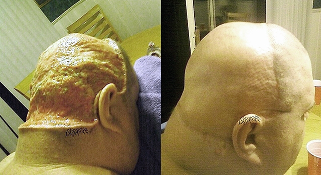 OH HELL NO! GUY SCALPS FRIEND DURING 'HOMEMADE SURGERY'