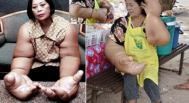HEY HULK HOGAN: THESE ARE THE BIGGEST ARMS IN THE WORLD