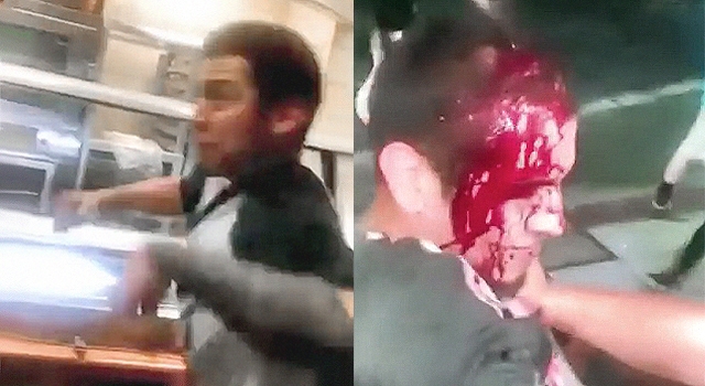 WHEN HEADBUTTING IN A FIGHT GOES HORRIBLY WRONG