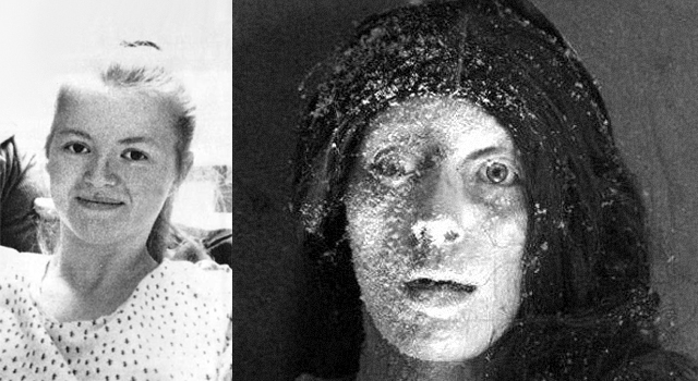 THE GIRL WHO SURVIVED BEING FROZEN ALIVE