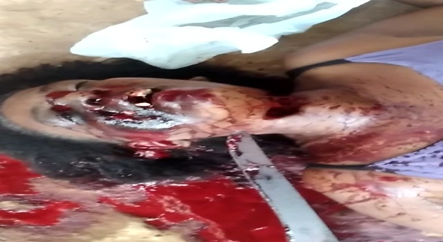 woman with knife stuck in her neck