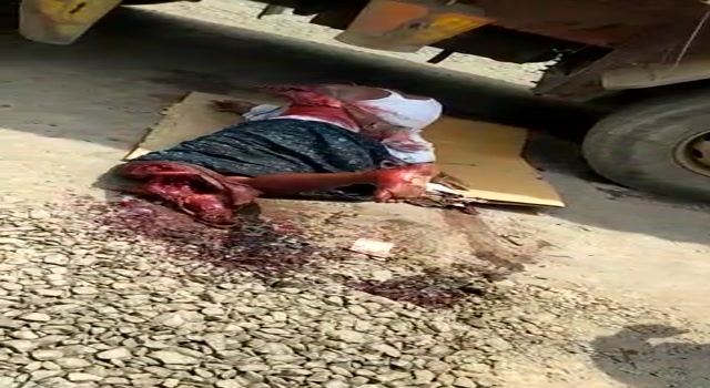 fucking brutal , man have leg and arm cut