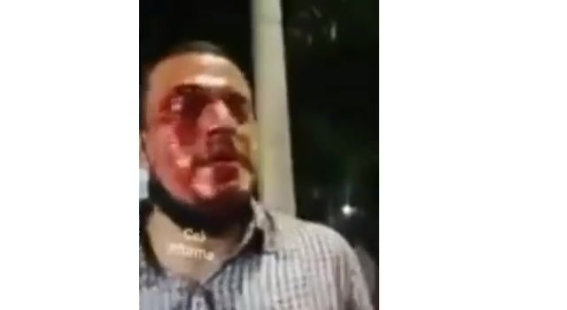 protesters shot in Colombia
