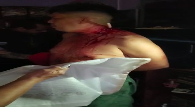 crazy man from brasil with knife stuck in neck