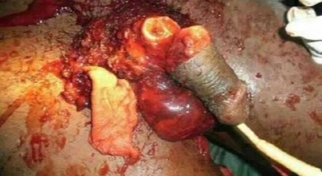 Severed…..