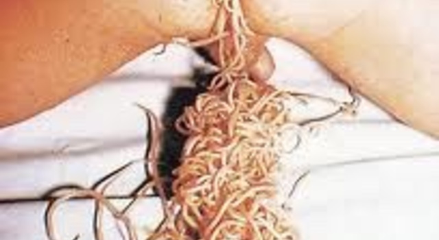 Worms…..