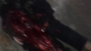 Man has legs crushed by truck