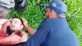 Extreme pain , motorcyclist has his leg amputated on Brazilian highway