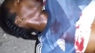 man with exposed intestines