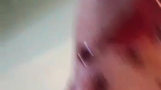 Prisoner shot with rubber bullets