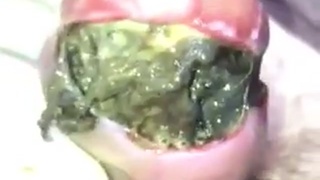 Infected pecker