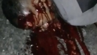 Horrible agony