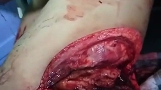 Slice