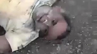 Biker in terrible agony ,