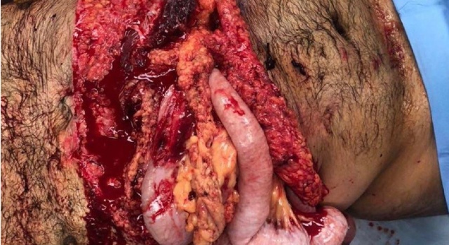 Insides…..