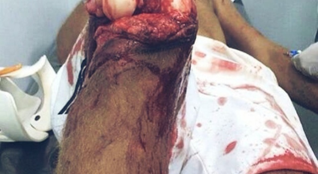 Knee