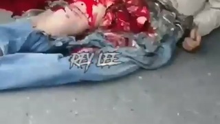 man with his skinned testicles and his penis