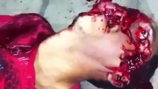 Massive head wound Harry
