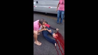 Man's leg severed in accident