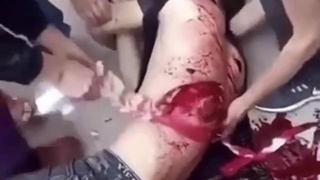 I think they&rsquo;re gonna need more gauze