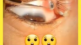 eye spy