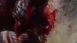 stabbed in face