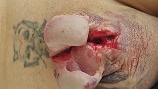 Splitcock