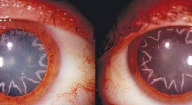 Seeing…..