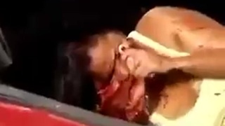 face and eyes hanging in accident